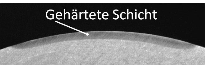 Laser surface treatment